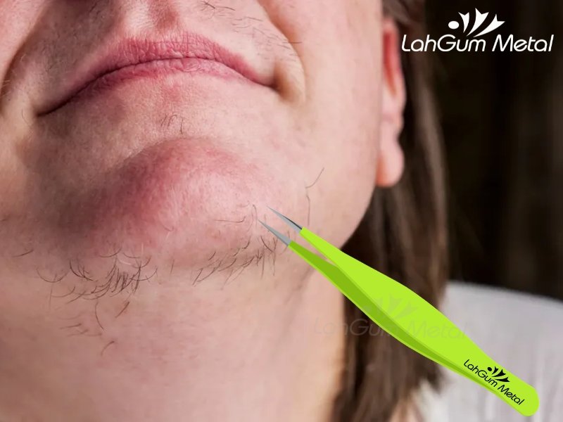 Tweezers for ingrown hair on chin female with sharp pointed tip for safe and precise hair extraction