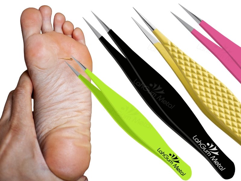 Tweezers removing splinter from foot using sharp pointed tips for deep and painful splinter extraction